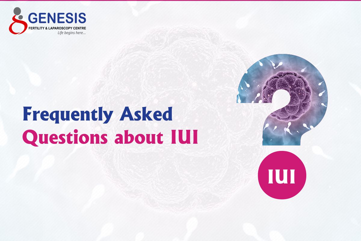 Questions about IUI
